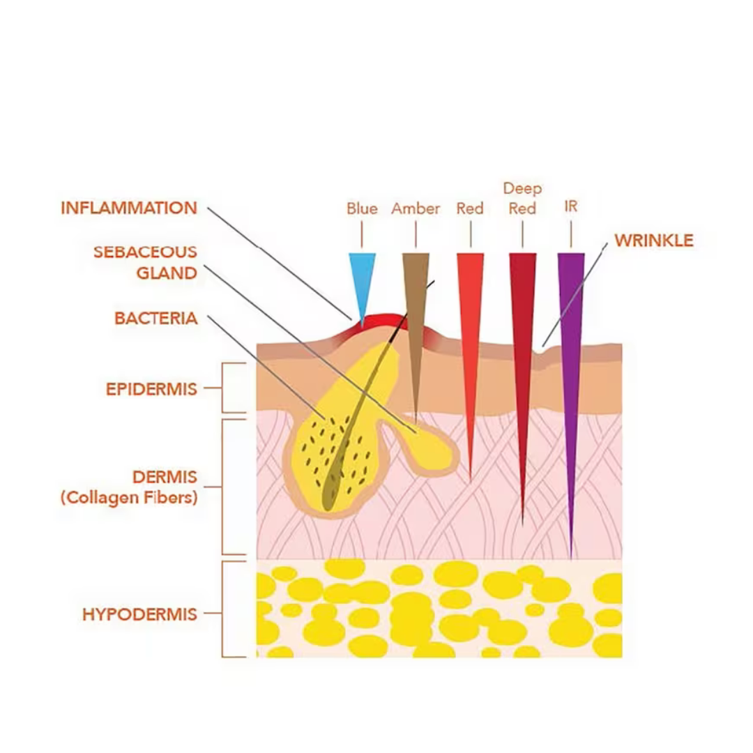 Dr. Dennis Gross - SpectraLite Faceware pro